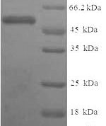 SDS-PAGE separation of QP6748 followed by commassie total protein stain results in a primary band consistent with reported data for SULT1A3. These data demonstrate Greater than 90% as determined by SDS-PAGE.