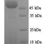 SDS-PAGE separation of QP6750 followed by commassie total protein stain results in a primary band consistent with reported data for Sulfite oxidase