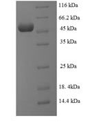 SDS-PAGE separation of QP6752 followed by commassie total protein stain results in a primary band consistent with reported data for SUPT3H. These data demonstrate Greater than 90% as determined by SDS-PAGE.