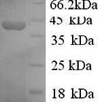 SDS-PAGE separation of QP6754 followed by commassie total protein stain results in a primary band consistent with reported data for Synapsin-1. These data demonstrate Greater than 90.5% as determined by SDS-PAGE.