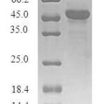 SDS-PAGE separation of QP6755 followed by commassie total protein stain results in a primary band consistent with reported data for Synaptogyrin-1. These data demonstrate Greater than 80% as determined by SDS-PAGE.