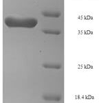 SDS-PAGE separation of QP6756 followed by commassie total protein stain results in a primary band consistent with reported data for Transgelin-2. These data demonstrate Greater than 90% as determined by SDS-PAGE.