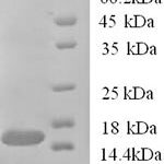 SDS-PAGE separation of QP6760 followed by commassie total protein stain results in a primary band consistent with reported data for TANK. These data demonstrate Greater than 90% as determined by SDS-PAGE.