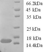 SDS-PAGE separation of QP6760 followed by commassie total protein stain results in a primary band consistent with reported data for TANK. These data demonstrate Greater than 90% as determined by SDS-PAGE.