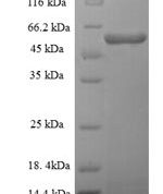 SDS-PAGE separation of QP6762 followed by commassie total protein stain results in a primary band consistent with reported data for Threonine--tRNA ligase