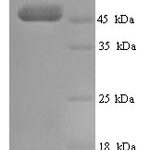 SDS-PAGE separation of QP6769 followed by commassie total protein stain results in a primary band consistent with reported data for Transcobalamin-1. These data demonstrate Greater than 90% as determined by SDS-PAGE.