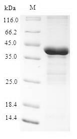 SDS-PAGE separation of QP6772 followed by commassie total protein stain results in a primary band consistent with reported data for Calcineurin B homologous protein 3. These data demonstrate Greater than 90% as determined by SDS-PAGE.