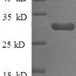 SDS-PAGE separation of QP6775 followed by commassie total protein stain results in a primary band consistent with reported data for Tissue factor pathway inhibitor. These data demonstrate Greater than 90% as determined by SDS-PAGE.