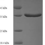 SDS-PAGE separation of QP6777 followed by commassie total protein stain results in a primary band consistent with reported data for TGF-alpha. These data demonstrate Greater than 90% as determined by SDS-PAGE.