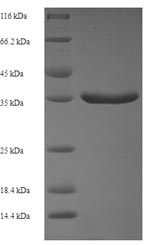 SDS-PAGE separation of QP6777 followed by commassie total protein stain results in a primary band consistent with reported data for TGF-alpha. These data demonstrate Greater than 90% as determined by SDS-PAGE.