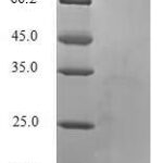 SDS-PAGE separation of QP6778 followed by commassie total protein stain results in a primary band consistent with reported data for TGF-beta 1 / TGFB1. These data demonstrate Greater than 90% as determined by SDS-PAGE.