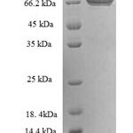 SDS-PAGE separation of QP6784 followed by commassie total protein stain results in a primary band consistent with reported data for Transglutaminase II. These data demonstrate Greater than 90% as determined by SDS-PAGE.