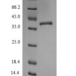 SDS-PAGE separation of QP6785 followed by commassie total protein stain results in a primary band consistent with reported data for Thrombospondin-1. These data demonstrate Greater than 90% as determined by SDS-PAGE.