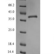 SDS-PAGE separation of QP6785 followed by commassie total protein stain results in a primary band consistent with reported data for Thrombospondin-1. These data demonstrate Greater than 90% as determined by SDS-PAGE.
