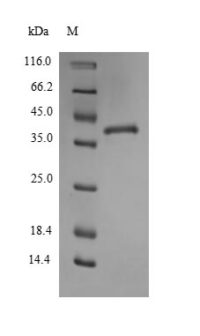 SDS-PAGE separation of QP6785 followed by commassie total protein stain results in a primary band consistent with reported data for Thrombospondin-1. These data demonstrate Greater than 90% as determined by SDS-PAGE.