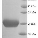 SDS-PAGE separation of QP6786 followed by commassie total protein stain results in a primary band consistent with reported data for Thrombospondin-2. These data demonstrate Greater than 90% as determined by SDS-PAGE.