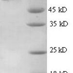 SDS-PAGE separation of QP6787 followed by commassie total protein stain results in a primary band consistent with reported data for Thrombospondin-3. These data demonstrate Greater than 90% as determined by SDS-PAGE.