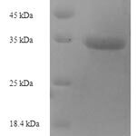 SDS-PAGE separation of QP6795 followed by commassie total protein stain results in a primary band consistent with reported data for TIMP-1 / TIMP1. These data demonstrate Greater than 90% as determined by SDS-PAGE.