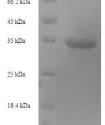 SDS-PAGE separation of QP6795 followed by commassie total protein stain results in a primary band consistent with reported data for TIMP-1 / TIMP1. These data demonstrate Greater than 90% as determined by SDS-PAGE.