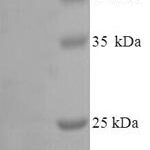 SDS-PAGE separation of QP6796 followed by commassie total protein stain results in a primary band consistent with reported data for Metalloproteinase inhibitor 4. These data demonstrate Greater than 90% as determined by SDS-PAGE.