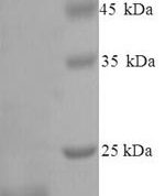 SDS-PAGE separation of QP6796 followed by commassie total protein stain results in a primary band consistent with reported data for Metalloproteinase inhibitor 4. These data demonstrate Greater than 90% as determined by SDS-PAGE.