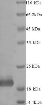 SDS-PAGE separation of QP6796 followed by commassie total protein stain results in a primary band consistent with reported data for Metalloproteinase inhibitor 4. These data demonstrate Greater than 90% as determined by SDS-PAGE.