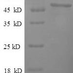 SDS-PAGE separation of QP6799 followed by commassie total protein stain results in a primary band consistent with reported data for Thymidine kinase. These data demonstrate Greater than 90% as determined by SDS-PAGE.