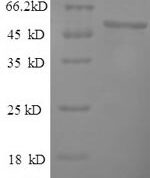 SDS-PAGE separation of QP6799 followed by commassie total protein stain results in a primary band consistent with reported data for Thymidine kinase. These data demonstrate Greater than 90% as determined by SDS-PAGE.