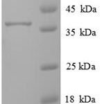 SDS-PAGE separation of QP6804 followed by commassie total protein stain results in a primary band consistent with reported data for Transmembrane protein 14B. These data demonstrate Greater than 90% as determined by SDS-PAGE.