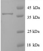 SDS-PAGE separation of QP6804 followed by commassie total protein stain results in a primary band consistent with reported data for Transmembrane protein 14B. These data demonstrate Greater than 90% as determined by SDS-PAGE.
