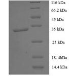 SDS-PAGE separation of QP6806 followed by commassie total protein stain results in a primary band consistent with reported data for Transmembrane protein 44. These data demonstrate Greater than 90% as determined by SDS-PAGE.