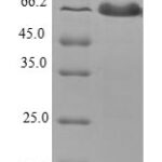 SDS-PAGE separation of QP6809 followed by commassie total protein stain results in a primary band consistent with reported data for Tropomodulin-1. These data demonstrate Greater than 80% as determined by SDS-PAGE.