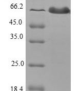 SDS-PAGE separation of QP6809 followed by commassie total protein stain results in a primary band consistent with reported data for Tropomodulin-1. These data demonstrate Greater than 80% as determined by SDS-PAGE.