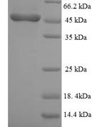 SDS-PAGE separation of QP6814 followed by commassie total protein stain results in a primary band consistent with reported data for TNFR2 / CD120b / TNFRSF1B. These data demonstrate Greater than 90% as determined by SDS-PAGE.