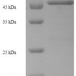 SDS-PAGE separation of QP6815 followed by commassie total protein stain results in a primary band consistent with reported data for DR6 / TNFRSF21. These data demonstrate Greater than 90% as determined by SDS-PAGE.