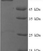 SDS-PAGE separation of QP6823 followed by commassie total protein stain results in a primary band consistent with reported data for p53 / TP53. These data demonstrate Greater than 90% as determined by SDS-PAGE.