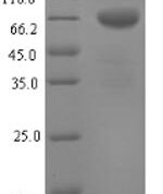 SDS-PAGE separation of QP6826 followed by commassie total protein stain results in a primary band consistent with reported data for Tryptophan Hydroxylase 1 / TPH1. These data demonstrate Greater than 90% as determined by SDS-PAGE.