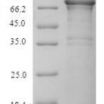 SDS-PAGE separation of QP6829 followed by commassie total protein stain results in a primary band consistent with reported data for Thyroid peroxidase / TPO. These data demonstrate Greater than 90% as determined by SDS-PAGE.