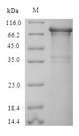 SDS-PAGE separation of QP6829 followed by commassie total protein stain results in a primary band consistent with reported data for Thyroid peroxidase / TPO. These data demonstrate Greater than 90% as determined by SDS-PAGE.