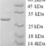 SDS-PAGE separation of QP6831 followed by commassie total protein stain results in a primary band consistent with reported data for Tryptase. These data demonstrate Greater than 90% as determined by SDS-PAGE.