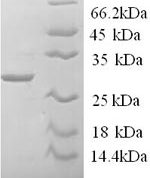 SDS-PAGE separation of QP6831 followed by commassie total protein stain results in a primary band consistent with reported data for Tryptase. These data demonstrate Greater than 90% as determined by SDS-PAGE.