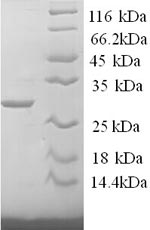 SDS-PAGE separation of QP6831 followed by commassie total protein stain results in a primary band consistent with reported data for Tryptase. These data demonstrate Greater than 90% as determined by SDS-PAGE.