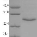 SDS-PAGE separation of QP6832 followed by commassie total protein stain results in a primary band consistent with reported data for Tryptase beta-2. These data demonstrate Greater than 90% as determined by SDS-PAGE.