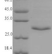 SDS-PAGE separation of QP6832 followed by commassie total protein stain results in a primary band consistent with reported data for Tryptase beta-2. These data demonstrate Greater than 90% as determined by SDS-PAGE.