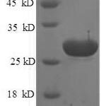 SDS-PAGE separation of QP6835 followed by commassie total protein stain results in a primary band consistent with reported data for TPT1 / Tumor. These data demonstrate Greater than 90% as determined by SDS-PAGE.