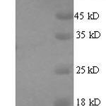 SDS-PAGE separation of QP6836 followed by commassie total protein stain results in a primary band consistent with reported data for T-cell receptor alpha chain C region. These data demonstrate Greater than 90% as determined by SDS-PAGE.