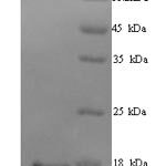 SDS-PAGE separation of QP6842 followed by commassie total protein stain results in a primary band consistent with reported data for Transcription intermediary factor 1-alpha. These data demonstrate Greater than 90% as determined by SDS-PAGE.