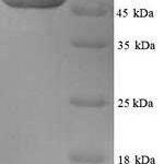 SDS-PAGE separation of QP6852 followed by commassie total protein stain results in a primary band consistent with reported data for Tubulin beta-2A chain. These data demonstrate Greater than 90% as determined by SDS-PAGE.