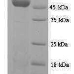 SDS-PAGE separation of QP6854 followed by commassie total protein stain results in a primary band consistent with reported data for Elongation factor Tu. These data demonstrate Greater than 90% as determined by SDS-PAGE.