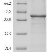 SDS-PAGE separation of QP6858 followed by commassie total protein stain results in a primary band consistent with reported data for TXNDC17 / TRP14 / TXNL5. These data demonstrate Greater than 90% as determined by SDS-PAGE.